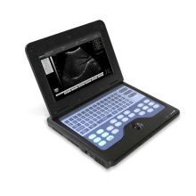 Contec CMS600P2 Escáner de ultrasonido portátil Sistema de diagnóstico Ultrsound para humanos